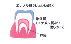 知っておきましょう虫歯の進行状況